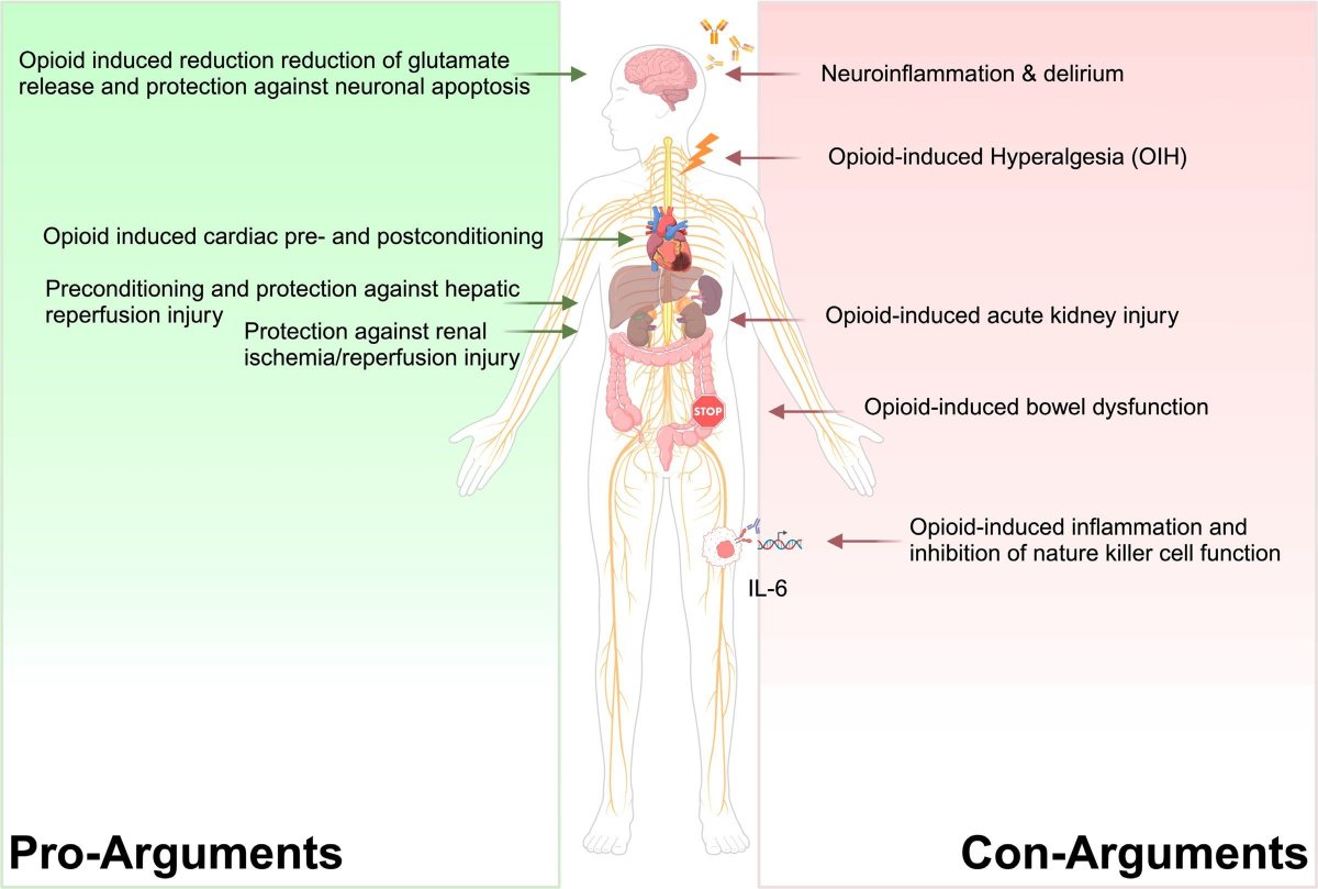 Friend or foe in the OR?
Can #opioids protect organs during #surgery, or do their risks outweigh benefit? 
buff.ly/0GzKaa1 

#Anesthesiology 🫀⚖️
#PerioperativeMedicine #CriticalCare #OpioidStewardship #PatientSafety