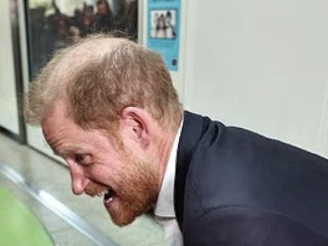 Harry’s testicle head covered in pube strands is a living testament to the fact that he is a gigantic dickhead.
