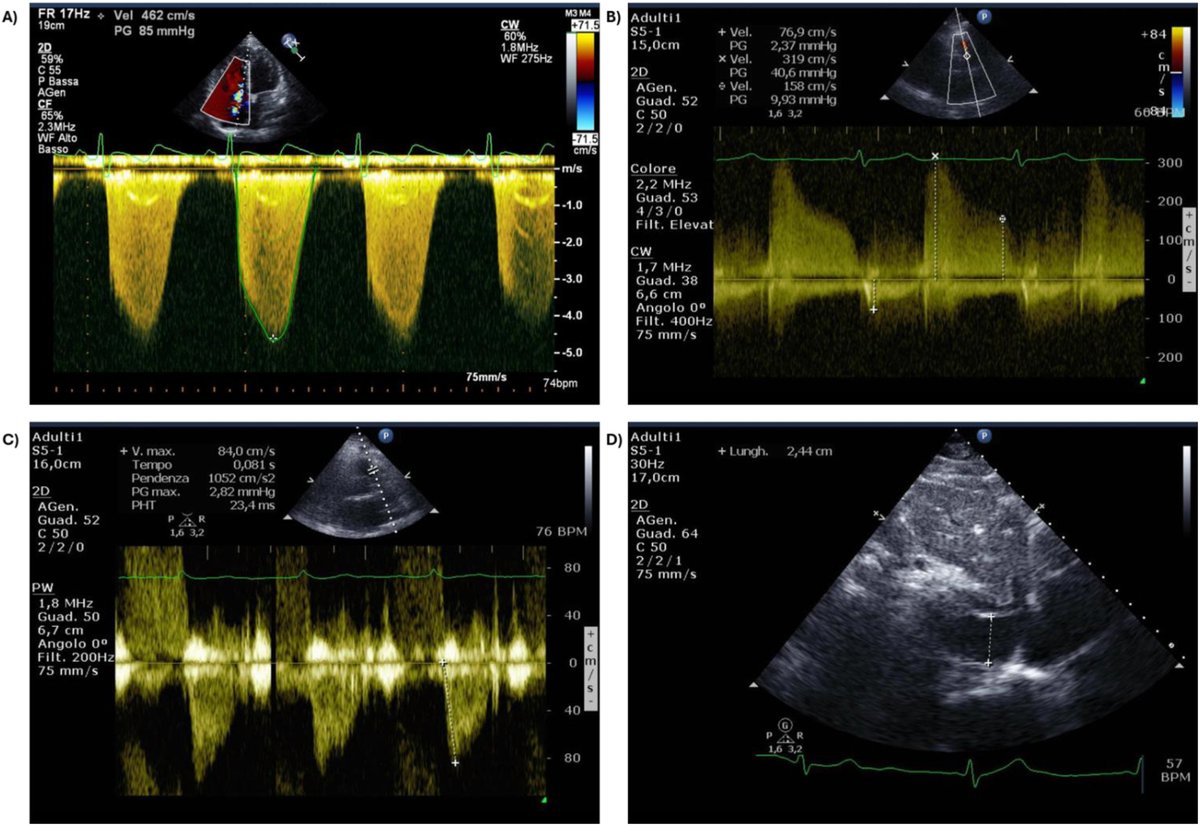 American Society of Echocardiography tweet media