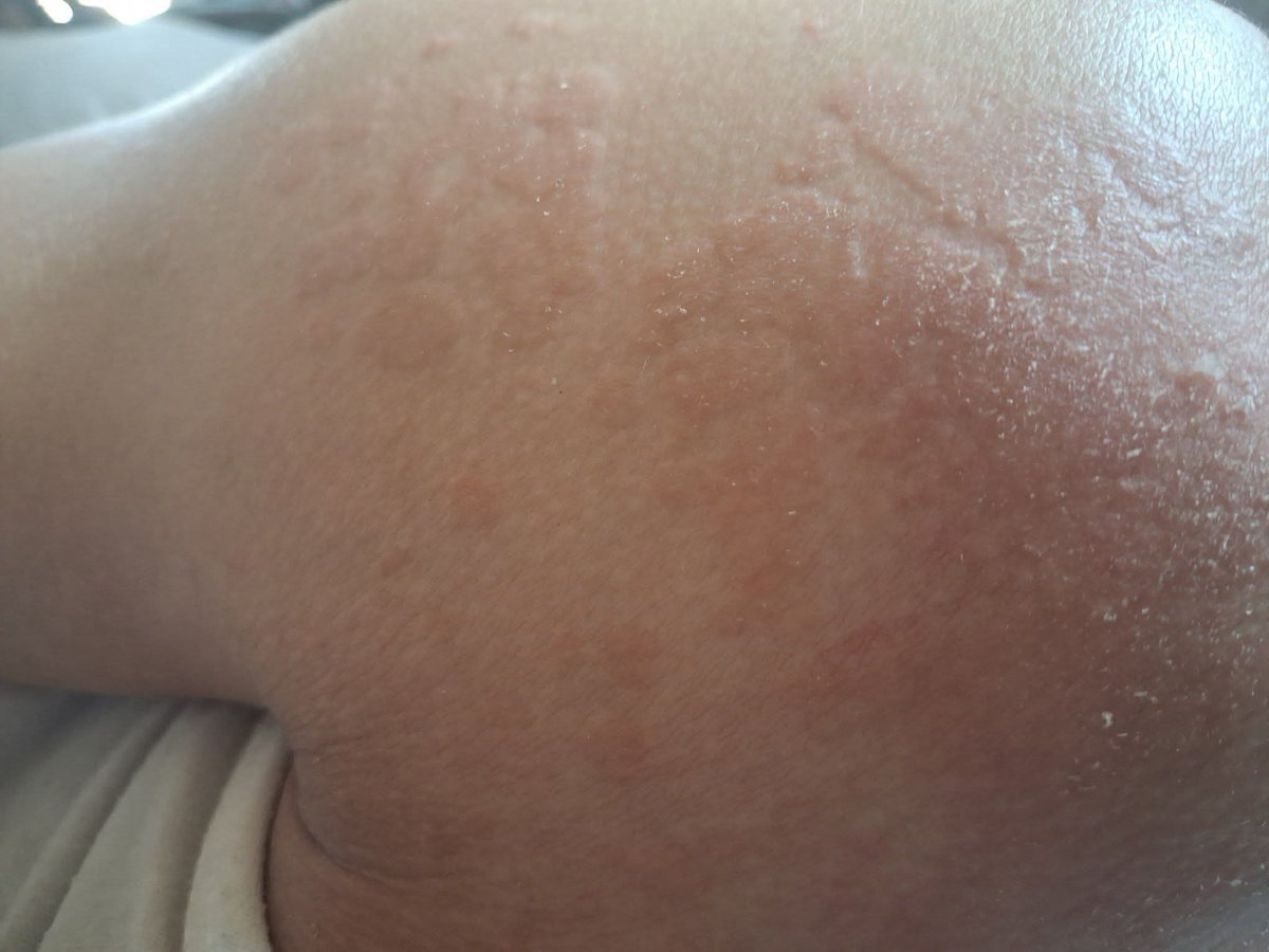 🍉🍉Namir Qasim tweet media