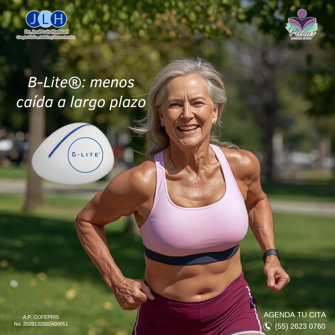 DrJoseHaddad's tweet photo. ✨️Los implantes B-Lite® ayudan a reducir la caída natural de los senos con los años porque pesan 30% menos que los tradicionales. 
✔️Es una buena opción para mujeres que quieren un resultado que dure más tiempo.

#ImplantesBLite #MenosCaida #DrHaddadCDMX #Polytech https://t.co/892MJH4X1J