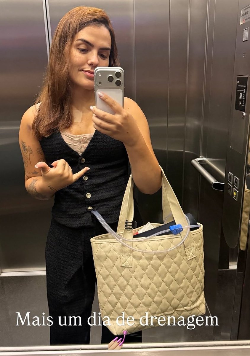 flaviorodriguer's tweet photo. E pensar que o peito da nossa deusa bruna sunaika era assim. DEPOIS X ANTES Agora depois de 2 cirurgias p diminuir esses 2 peitao dela minha piroca fica triste demaia. Vm ver se ela vai continuar boa

#PINTOAWARDS 
#PINTOSAWARDS 
#PINTOAWARD 
#PINTOSAWARD 
#XOTAAWARDS 
#XOTAWARDS https://t.co/vN1UlE1c6q