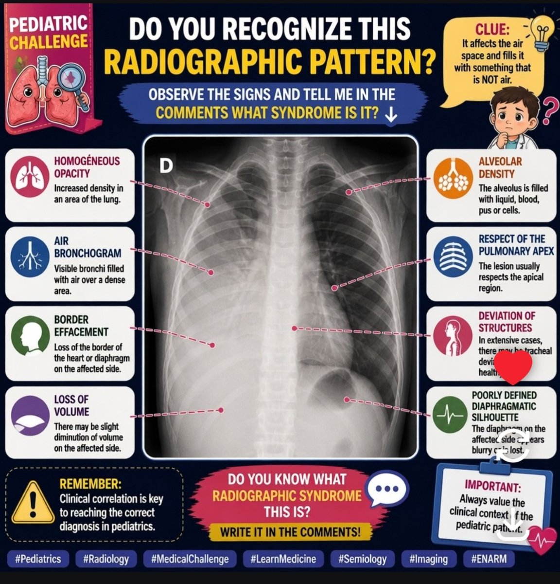 🩻 **RADIOLOGICAL CHALLENGE** In this chest X-ray there are several key ...
