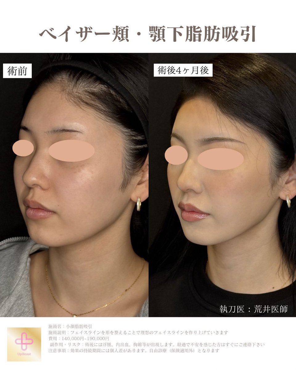 UBクリニック錦糸町院長👩‍⚕️荒井香織@目元整形、クマ取り、ベイザー脂肪吸引の美容外科医 tweet media