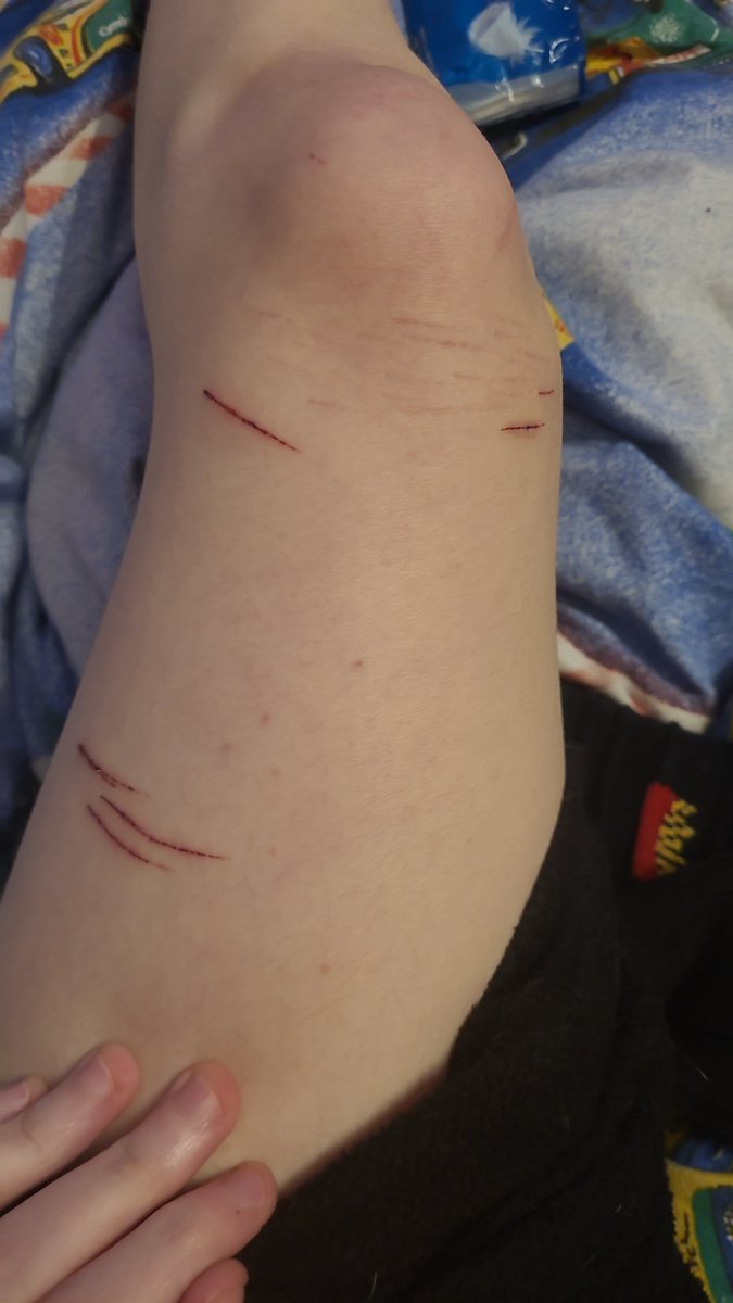 Marsh_mellowzz's tweet photo. small update on the cuts
#sh https://t.co/5LqBOn0h2t