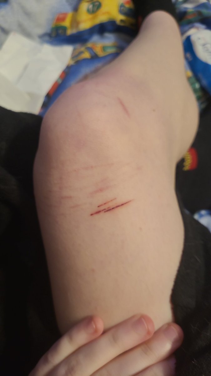 Marsh_mellowzz's tweet photo. small update on the cuts
#sh https://t.co/5LqBOn0h2t