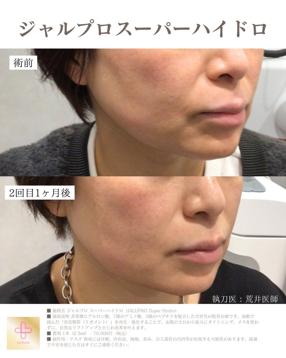 UBクリニック錦糸町院長👩‍⚕️荒井香織@目元整形、クマ取り、ベイザー脂肪吸引の美容外科医 tweet media