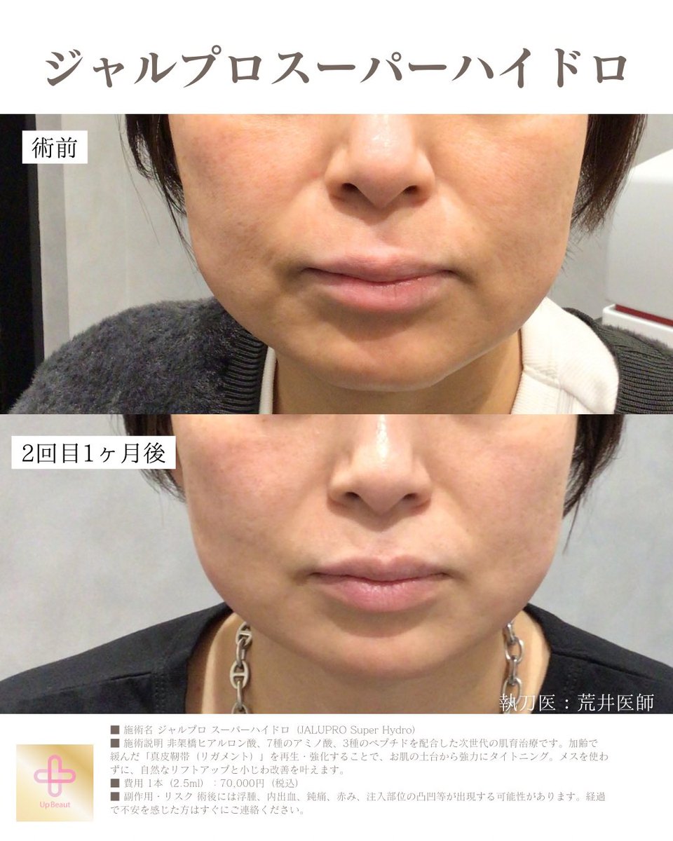 UBクリニック錦糸町院長👩‍⚕️荒井香織@目元整形、クマ取り、ベイザー脂肪吸引の美容外科医 tweet media