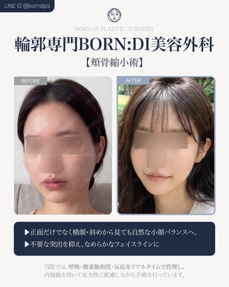 れい / 整形垢 tweet media