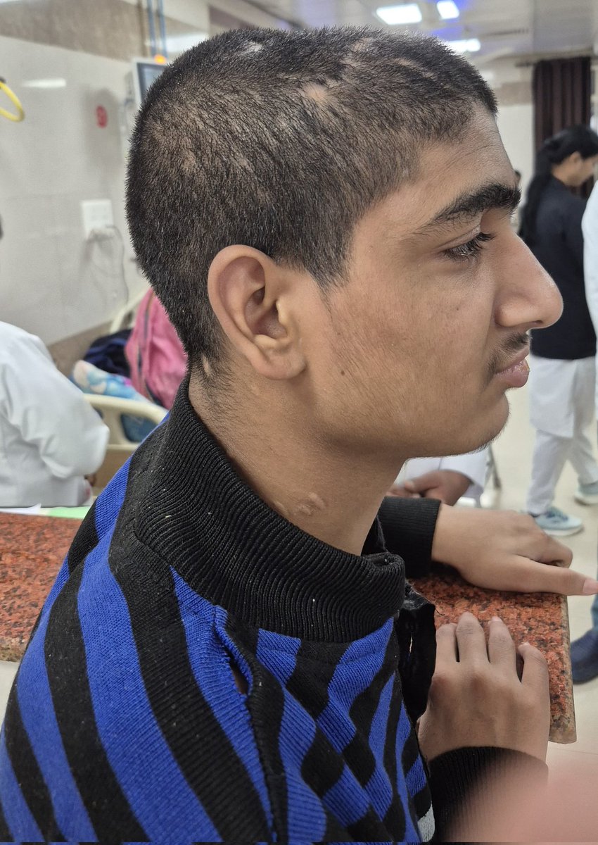 अति आवश्यक सूचना-  कृपया अधिक से अधिक Share करें ⚠️

ये लगभग 16 वर्ष का अज्ञात मरीज है, जो बीते साल 2025 में 7 अगस्त को बाराबंकी में ट्रेन से गिर गया था। उसे उसी दिन KGMU, लखनऊ में भर्ती कराया गया।

 इनके सिर में गंभीर चोट थी और 8 अगस्त को ऑपरेशन किया गया।

वर्तमान में ये लड़का