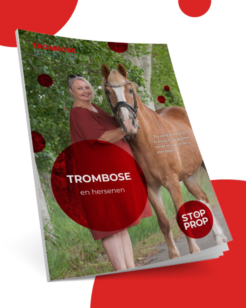 Trombosestng's tweet photo. Vandaag is het Europese Dag van de Beroerte. In Nederland krijgen jaarlijks meer dan 40.000 mensen hiermee te maken. Lees meer over de oorzaken, symptomen, risicofactoren in onze gratis brochure: https://t.co/PiV59vy6s6 https://t.co/4lo0kzBfGg