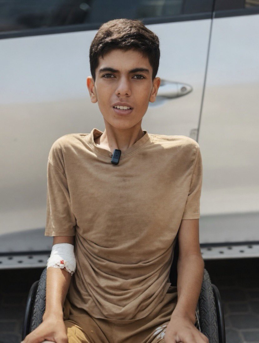 Abdulrahman Mohammed Al-Jourani was injured by shrapnel that caused severe abdominal injuries and seriousdamage to internal organs including the liver and intestinesWeurgently appeal to humanitarian organizations and all people of conscience to intervene please let save his life