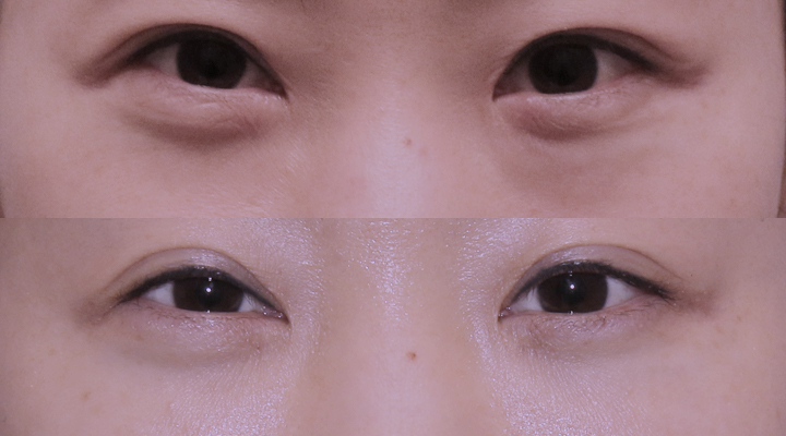 韓国ST美容整形外科 tweet media