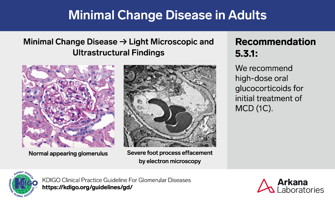 arkanalabs's tweet photo. A sample from the pathology teaching slide set on Minimal Change Disease in Adults, jointly prepared by Arkana Laboratories and @goKDIGO. https://t.co/KwXMfV3nTh
#KDIGO #pathology #renal #kidneypath https://t.co/79IJ2NTpFV