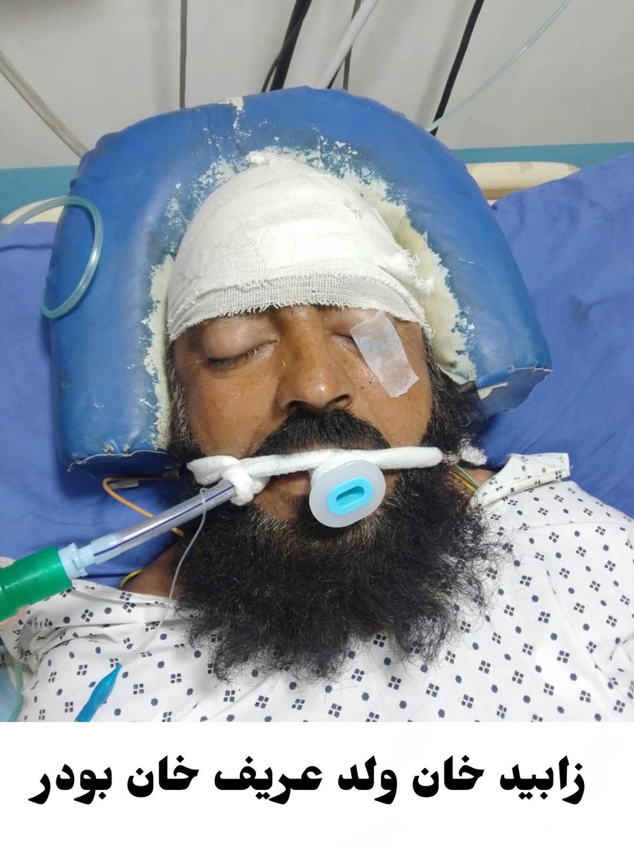 Mortar shells fired by the Pakistani army in #Shaktoi Waziristan hit a local home, leaving #ZubaidKhan critically injured, doctors say his condition is critical. This isn’t the first time—locals have faced such violence for years. #Shaktoi is under a security siege for years.