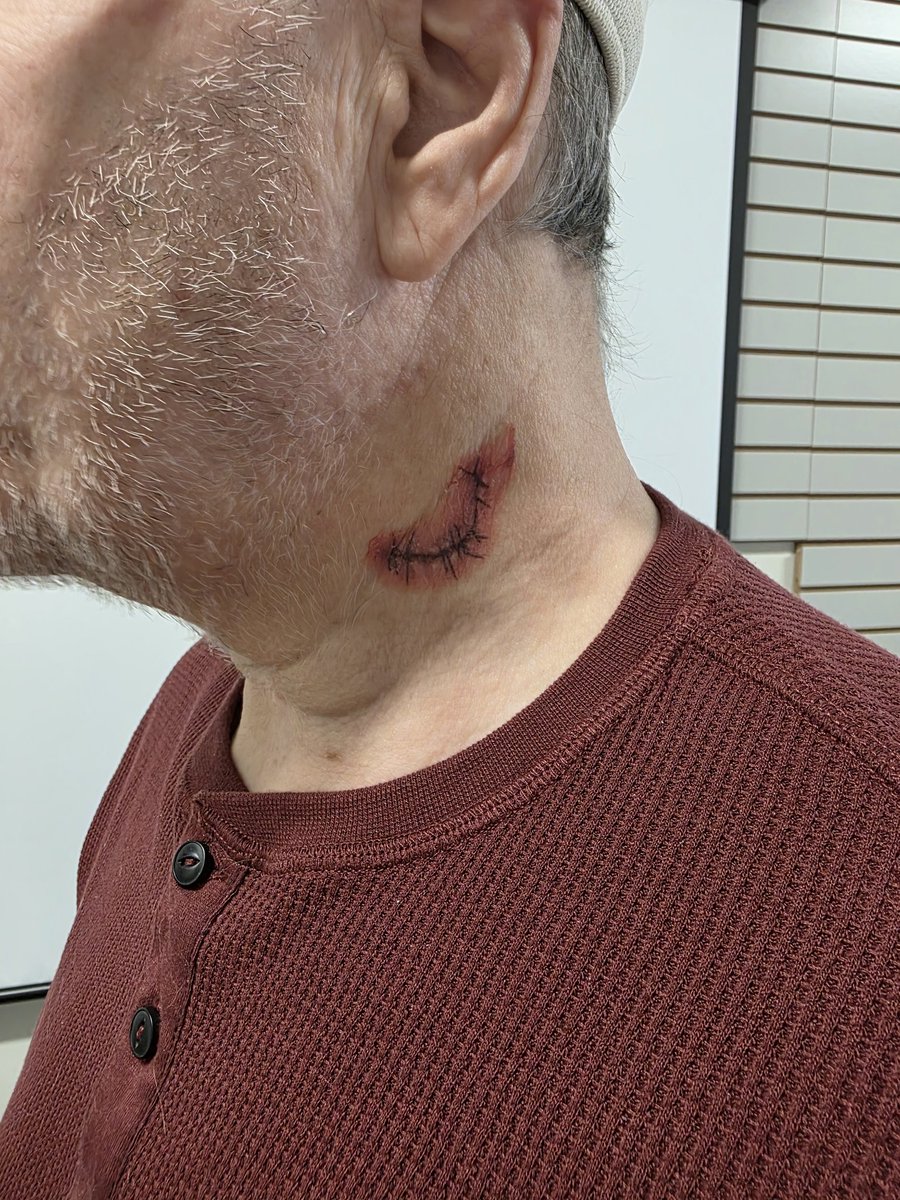 Michaeljos92972's tweet photo. LOTS OF NEWS!
MY NIECE GAVE BIRTH TO TWINS ( 2 GIRLS) LAST NIGHT. NO NAMES YET. 

I HAD TO GO TO HOSPITAL YESTERDAY. WHILE CUTTING BOXES, THE SHARP EDGE STRAIGHT EDGE BOX CUTTER FELL OFF THE TOP LEDGE AND PLUNGED INTO MY NECK. LUCKILY, 5 STITCHES FIXED THE PROBLEM. JUST ANOTHER DAY AT THE WHELAN HOUSE. 😎