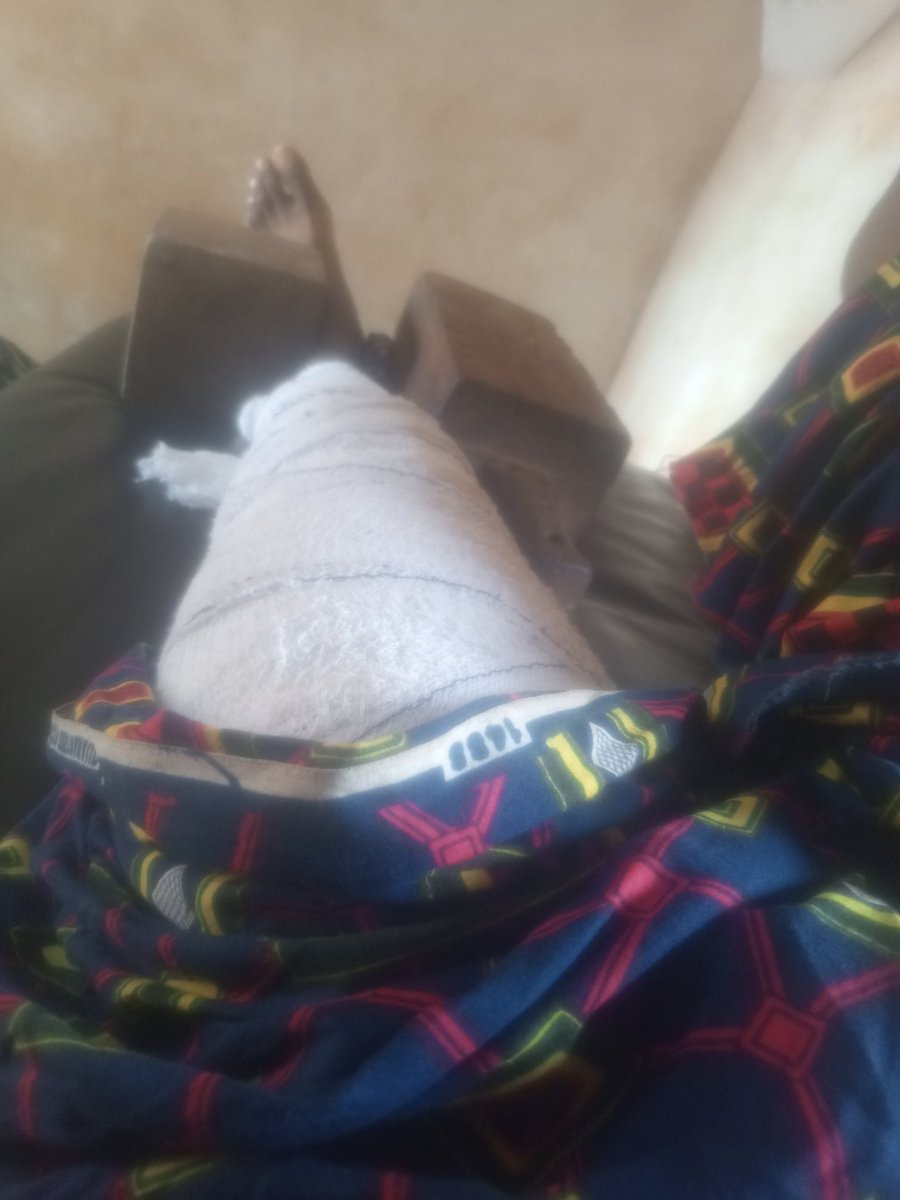 Gm family!!!

I'm in pain to tell you guys that I had an accident on Sunday and broke my leg 😭💔 
Thanks to <a href="/Anambraweb3/">Anambra Web3 Community</a> for their message and the well wishes ❤️🫂 

I believe that I will be fine soon 🙏🙏🙏🙏