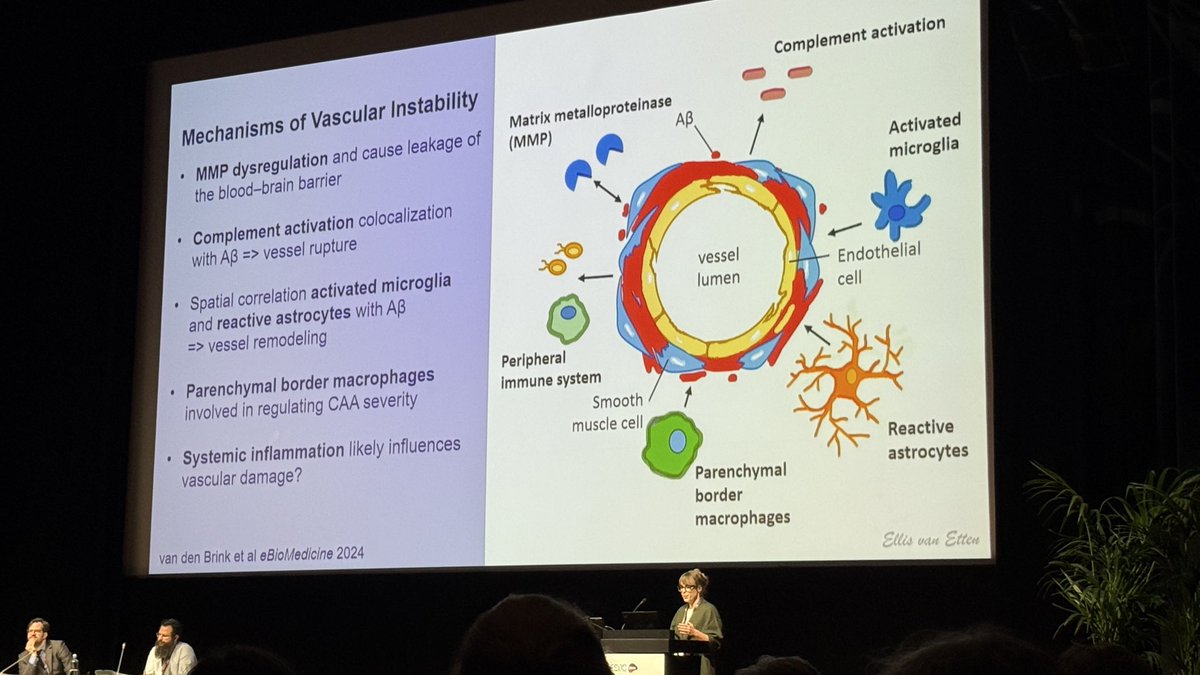 iCAAassociation's tweet photo. 🚨🧠 happening now: exciting session on CAA on the intersection between stroke, neurodegeneration x neuroinflammation covering a large spectrum of CAA from ICH to degeneration, neuroinflammation, iatrogenic forms and back! Thought provoking session. #ESOC2026 https://t.co/atB2CUruYl
