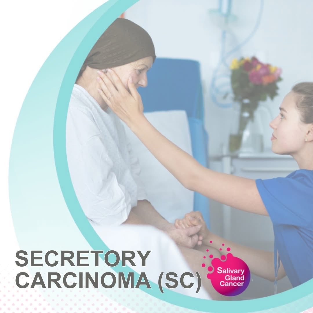 SGCancerUK's tweet photo. Secretory Carcinoma Is a typically a slow-growing, painless lump, most commonly found in the parotid gland or the minor salivary glands in the mouth. 
🔗 Read more about Secretory Carcinoma here: https://t.co/RBIlZO0QZz
#SGCUK #SecretoryCarcinoma #RareCancer #CancerAwareness https://t.co/AkUquaDhrf