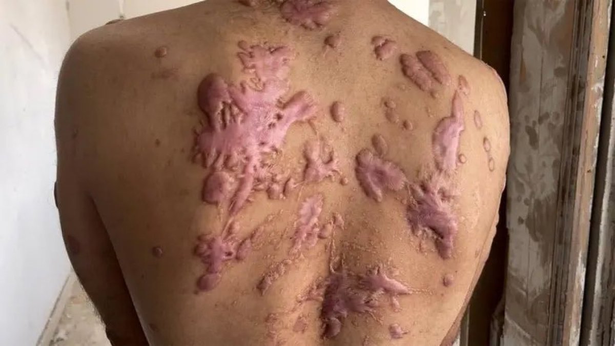 RamAbdu's tweet photo. Chemical burns, assaults, electric shocks - Gazans tell BBC of torture in Israeli detention
Full report: https://t.co/49BjCaNTgR https://t.co/UK88HaUZrm