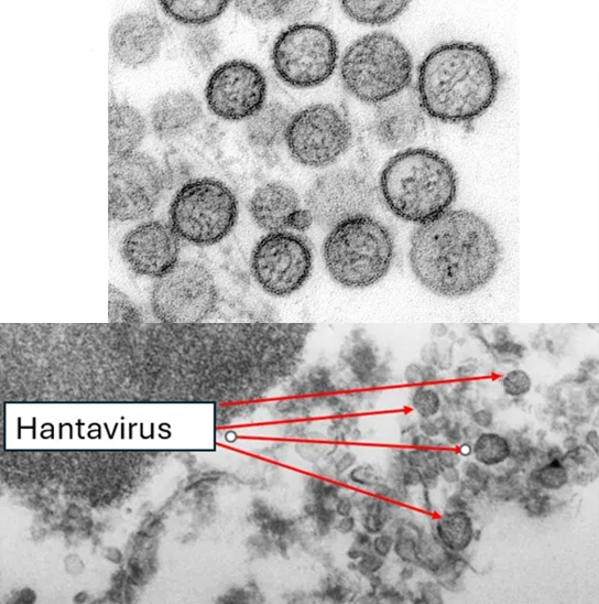 JamieAA_Again's tweet photo. Top Image: What the CDC claim is Hantavirus.

Bottom Image: Identically sized and shaped Cellular Debris in Uninfected Culture (Labelled Hantavirus). https://t.co/71YFiLrsH1