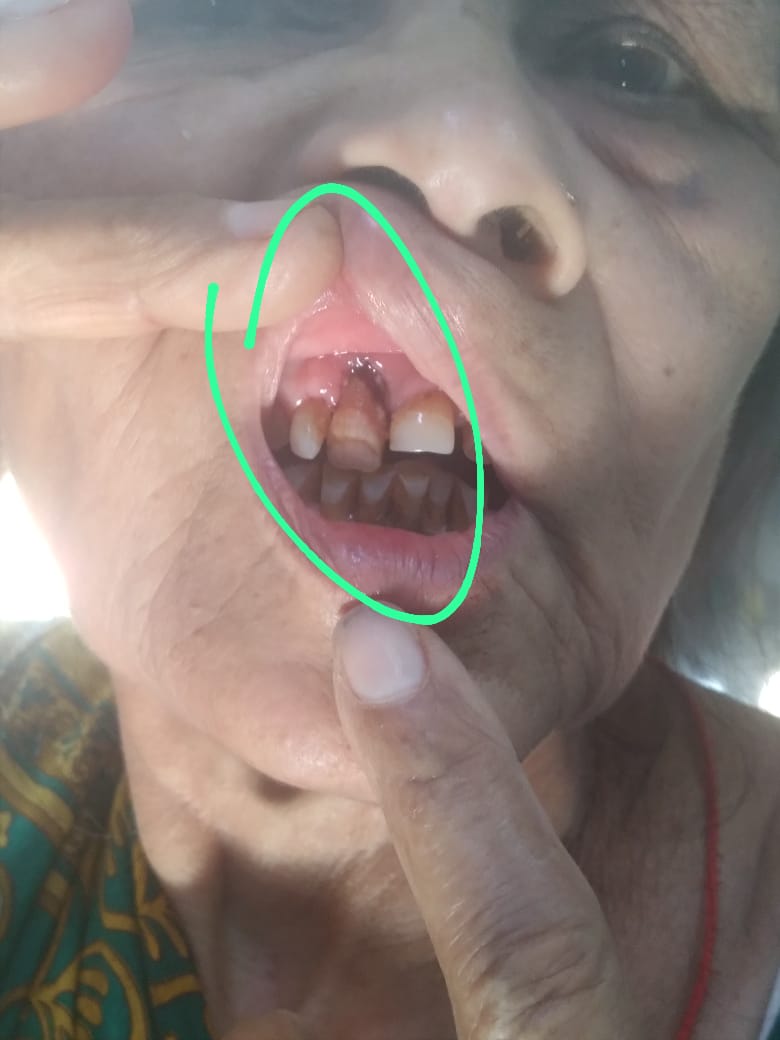 ANANTTRIVEDI_'s tweet photo. @RailwaySeva @AshwiniVaishnaw @RailMinIndia @RailwaySeva 
The name of TC is ADIL , meine dadi ko medical ke liye bheja hai sir , kindly bohot kadhi karyawahi honi chahiye adil pe , jisne itni old ko kara hai .
She's above 75 sir , age ka bhi dhyan nahi rakha . He should be suspended asap. https://t.co/V4vU1kk2Qg