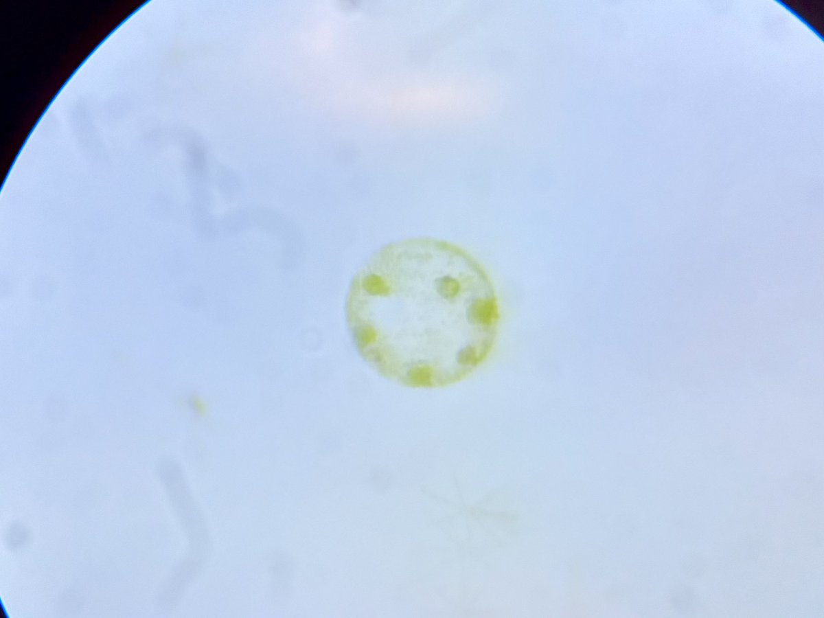 yuyarin's tweet photo. ボルボックスはじめて捕まえて観察できた。撮影が難しすぎる。水も不純物が多く臭くて培養は厳しそう。ボルボックスの人の凄さがわかった。 https://t.co/SaXMAYbnVa