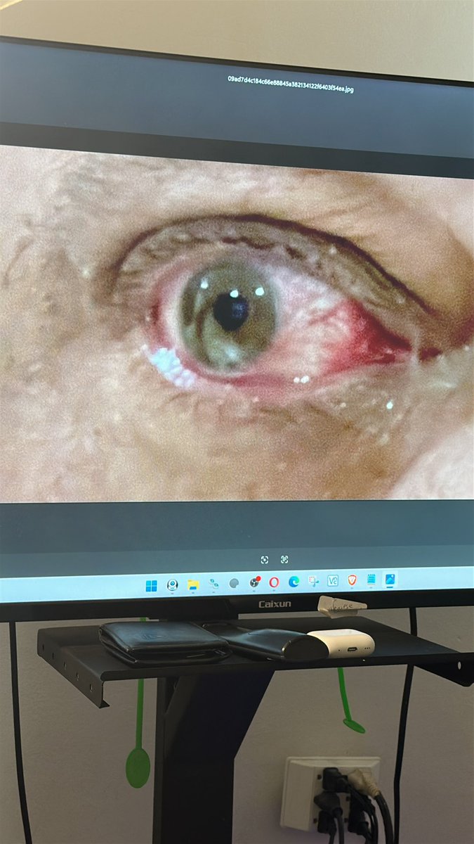 Michaelmagno_'s tweet photo. One guy made the eyes of this old pig  red …. And the pig feels scared of meet with me …. The reason I don’t have limits https://t.co/kQbNLgLYEs