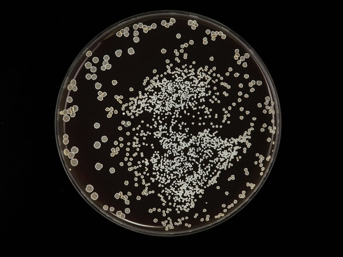 WellHumans's tweet photo. Restoring Gut Health After Candida: A Functional Approach https://t.co/zz3m3PvavV https://t.co/qgNNgK9sOl