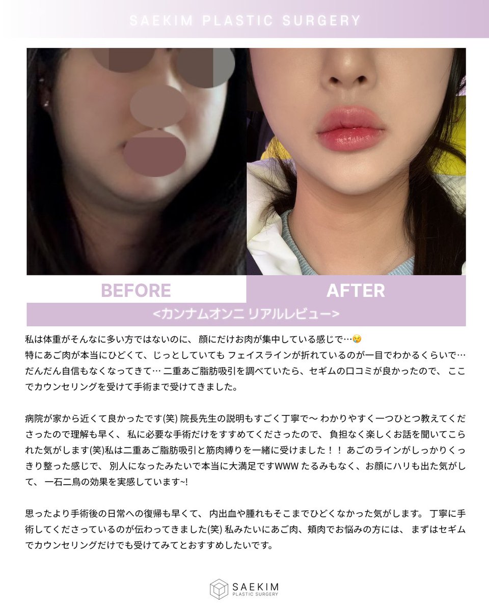❰公式❱💙セギム美容整形💙韓国 tweet media