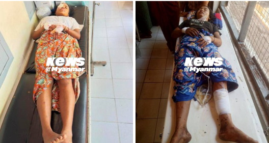 cs_zora's tweet photo. Two teenage girls (aged 16 and 17) sustained injuries in Bago's Htantabin Township after a heavy artillery shell fired by KNU and PDF joint forces hit near their home on May 3. They are currently being treated at Taungoo General Hospital.
#Myanmar #Bago #Taungoo #BreakingNews https://t.co/VdTOr9I8Is