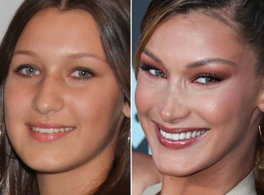 Whose face did Bella show to her surgeon tho?