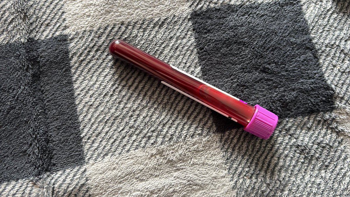 lcaitxx's tweet photo. @Ash_cinamoroll Omg I did the same thing on Monday!!! She let me pick out the color and how big the vial was https://t.co/YXBtZDDCCK