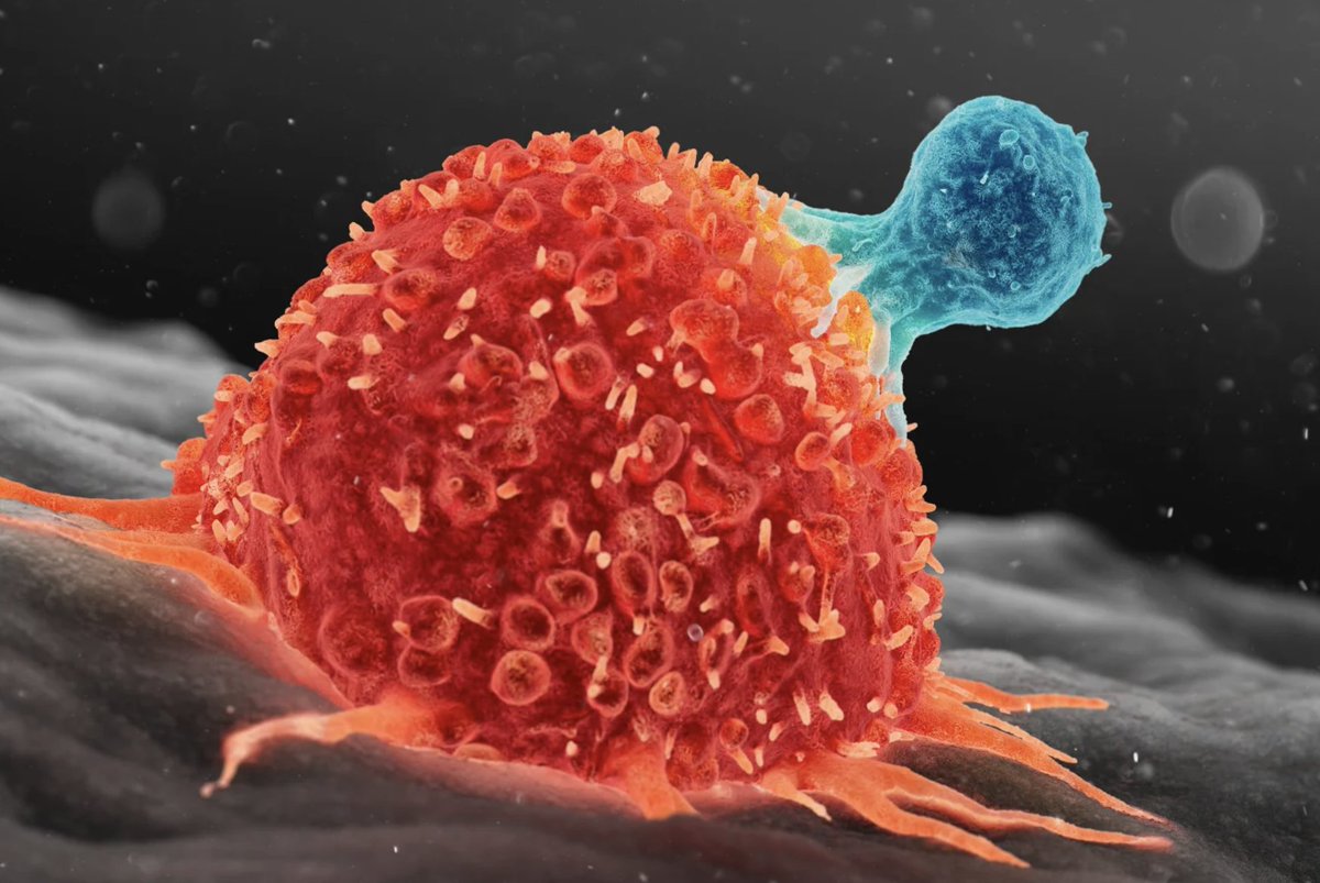 chayito09's tweet photo. Un linfocito T (azul) atacando a una célula cancerosa. La terapia celular ya está aquí: de la ciencia ficción (o laboratorios de investigación) a los hospitales.

©️Thom Leach/Science Photo Library. https://t.co/V55WE4BMP0