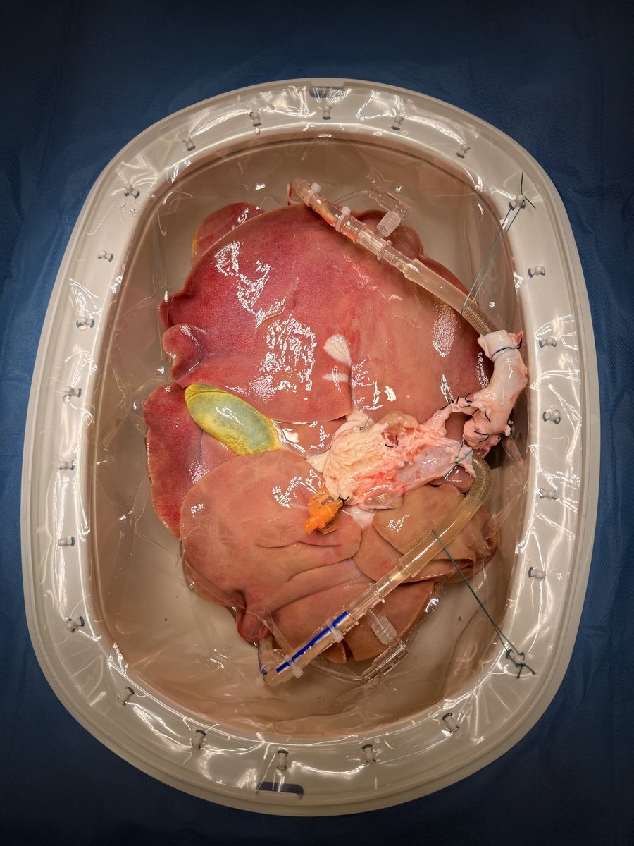 Paulo_MartinsMD's tweet photo. Another sold-out @_ILTS_ event! 6th hands-on #Liver Machine Perfusion workshop (ILTS 2026 Geneva). 

Thanks to our sponsors:
@XVIVOGroup 
@ORS_LifePort
@organ_ox 
@BridgetoLifeLTD 
@Aferetica_Srl 

#MachinePerfusion
@ASTSChimera 
@AST_LICOP 
@ISOPPT 

Specs of perfusion devices below: