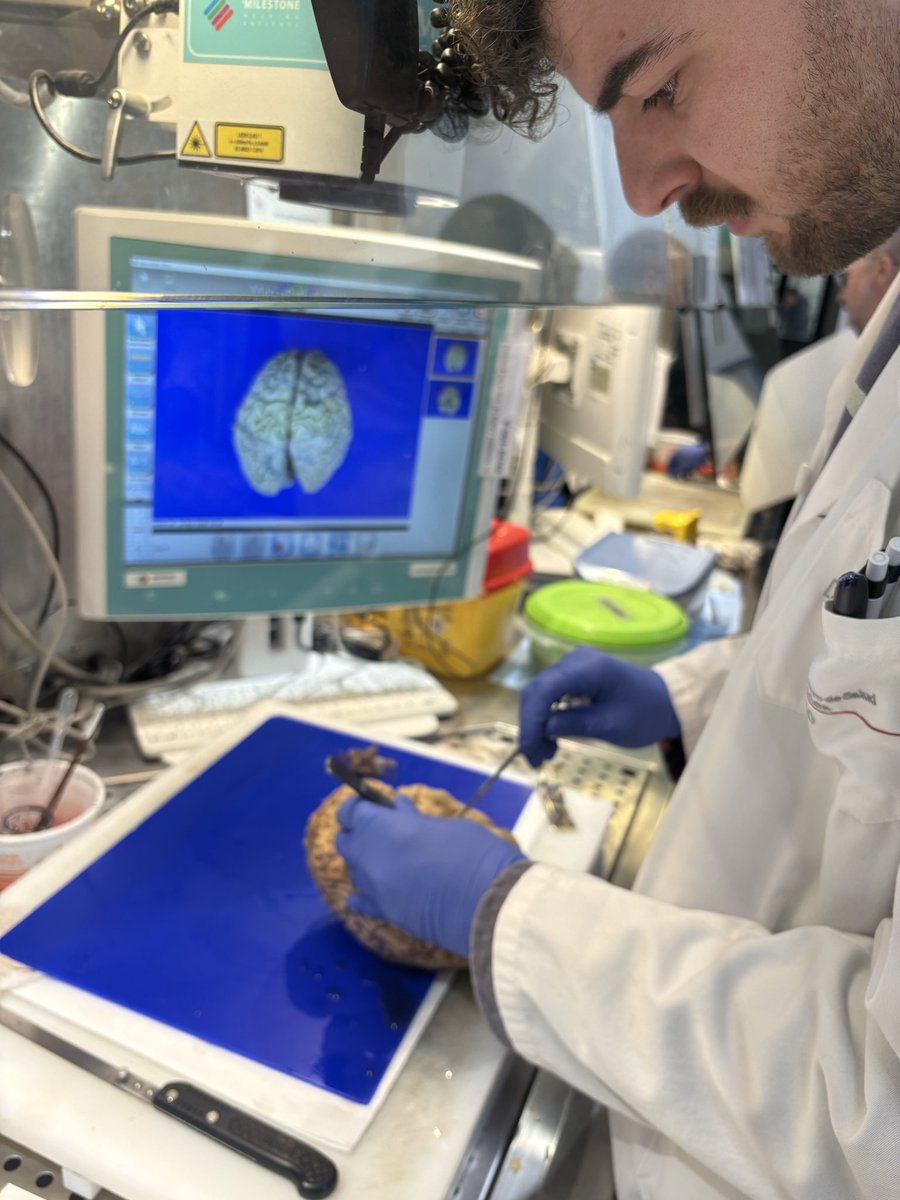 VickyZelaya5's tweet photo. We said goodbye to the future neuropathologist of Logroño Hospital. Elective rotation in our pathology department #HUN #Osasunbidea #patologia #navarrabiomed https://t.co/R2xe8qLDrg