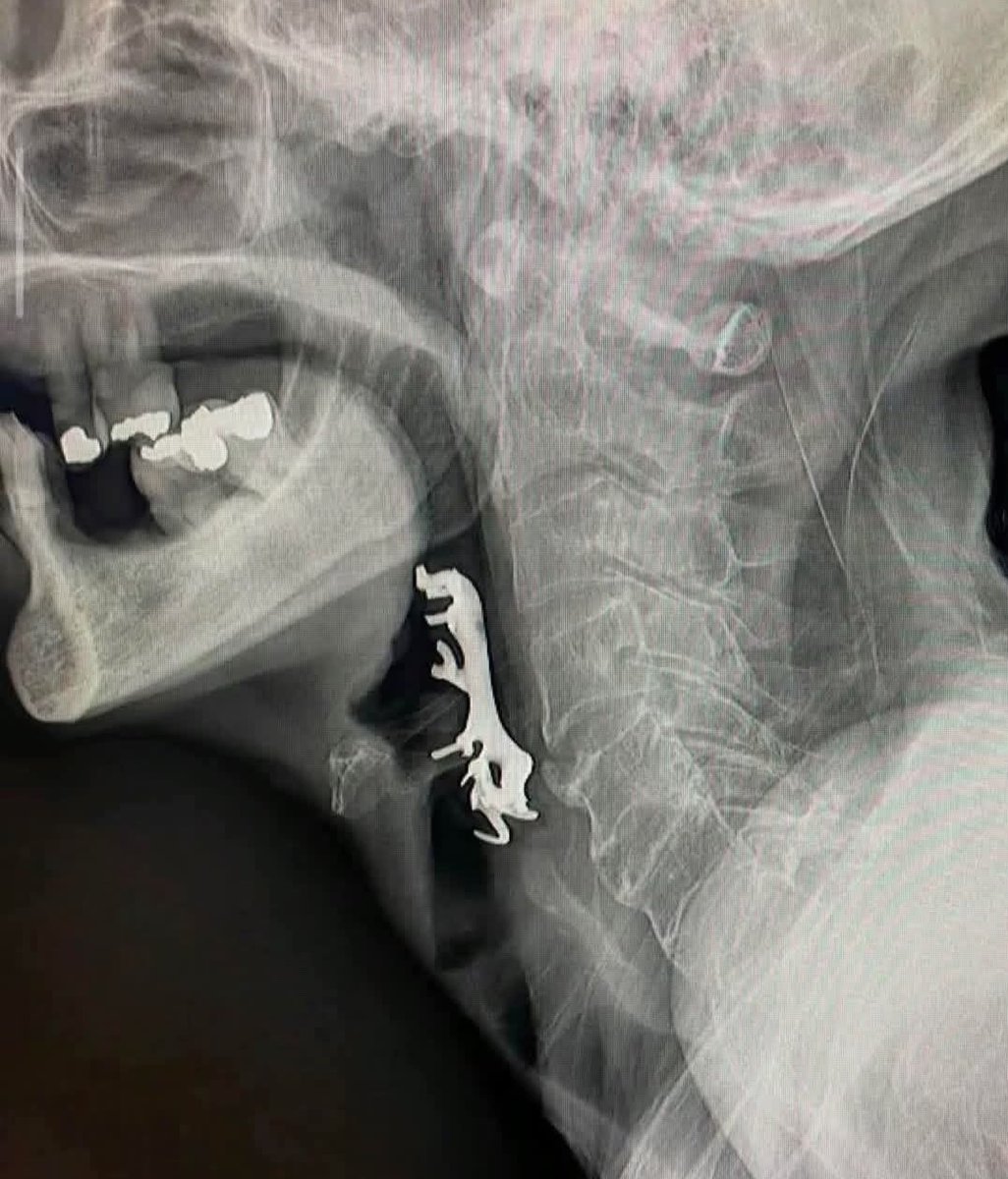 hakanakelma's tweet photo. Uzun zamandır Genç Tibbiyelilere soru sormuyordum. Başlıyayım ☺️

Boyun grafisinde görülen radyoopak durum nedir? Her düşünceye saygılıyım. ☺️ https://t.co/dTCeWC8R2S