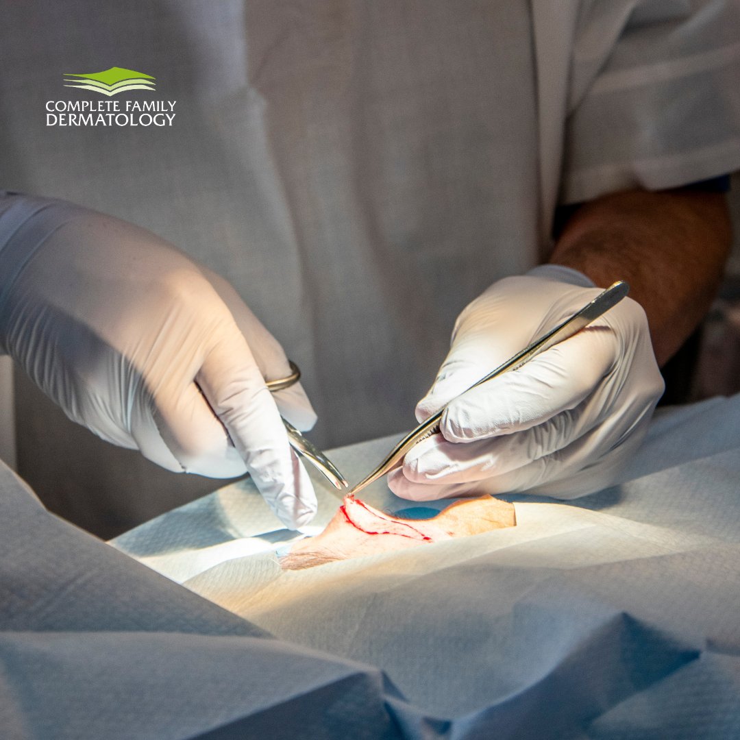 CompleteFamily7's tweet photo. Is Mohs surgery right for you? 🫵🏻

It’s the gold standard for treating many skin cancers especially in sensitive areas or for aggressive or recurring cases — with high precision and success!

Schedule a consultation to see if it’s the right option for you–402-423-1111 📞 https://t.co/2tRjUVcQhS