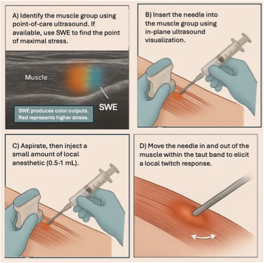 Rheumatology's tweet photo. Should we use ultrasound for trigger point injection???
https://t.co/Siv43QKlbf

https://t.co/Kj8cyC6iBW

https://t.co/VZEQKxQD1d https://t.co/WFBysvpPR6