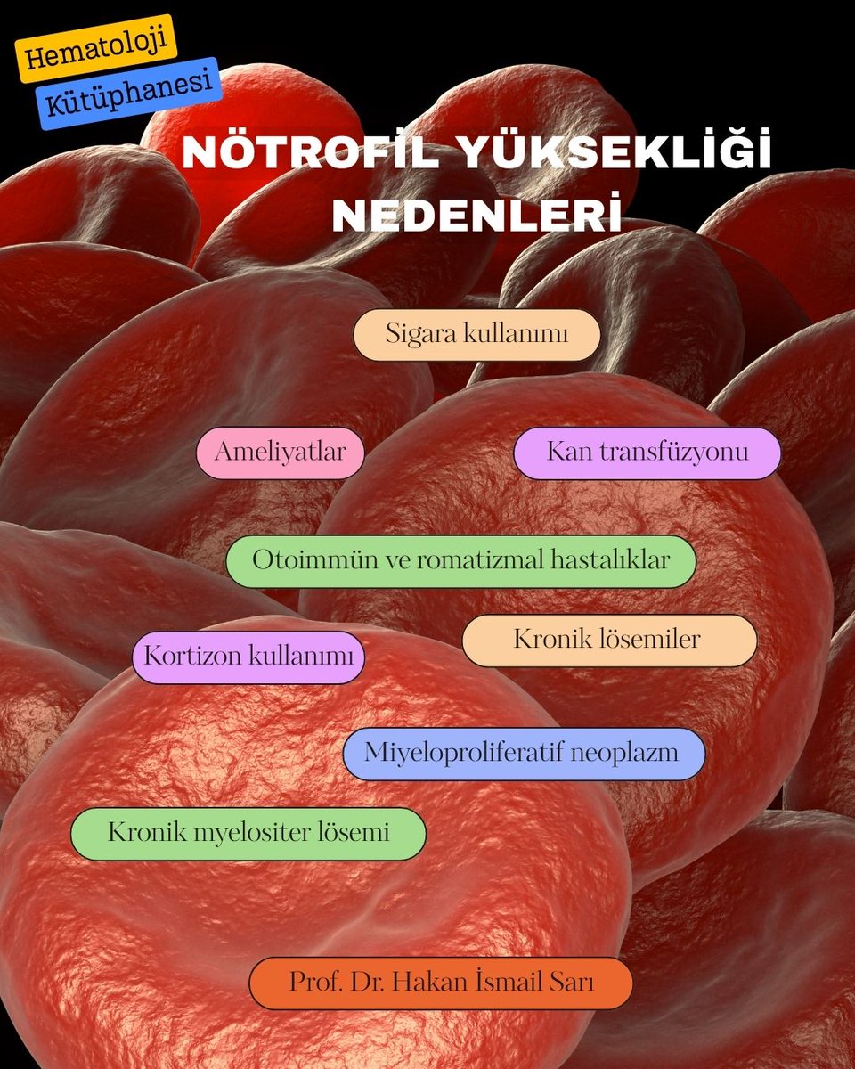 profdrhisari's tweet photo. 🔬 Kan Tahlilinde NEU Yüksekliği Ne Anlama Gelir?
Kan sayımı tetkikinizde gördüğünüz NEU (Nötrofil) değerinin yüksek olması vücudunuzun bir savunma modunda olduğunun işareti olabilir! Peki, nedir bu nötrofil ve neden yükselir? 🤔👇

🔹 Nötrofil Nedir?
Nötrofiller, beyaz kan hücrelerimizin (WBC - Lökosit) en önemli alt tiplerinden biridir. Vücudun "öncü birlikleri" gibi çalışırlar. 🛡️

✅ Normal Değerler:
Laboratuvara göre değişmekle birlikte, genellikle 1 mm³ kanda 1.500 - 7.500 arası normal kabul edilir.

🚀 Nötrofil Yüksekliğinin Nedenleri
Nötrofil yüksekliğinin (Nötrofili) en yaygın sebebi bakteriyel enfeksiyonlardır. 🦠 Ancak tek sebep bu değildir:

🚬 Yaşam Tarzı: Sigara kullanımı.
💉 Tıbbi Müdahaleler: Geçirilen ameliyatlar ve kan transfüzyonu.
💊 İlaçlar: Kortizon kullanımı.
🧬 Bağışıklık: Otoimmün ve romatizmal hastalıklar.

🩸 Kan Hastalıkları ve Nötrofil
Bazı durumlarda bu yükseklik doğrudan kan yapımıyla ilgili olabilir:

Kronik Lösemiler

Kronik Myelositer Lösemi (KML)

Miyeloproliferatif Neoplazm

⚠️ Unutmayın: Kan tahlili sonuçları bir bütündür ve en doğru değerlendirmeyi doktorunuz yapacaktır.

#profdrhakanismailsarı #hematolojiistanbul #kansayımı #nötrofil #bilgilendirme
                 https://t.co/rQp97MQ03k