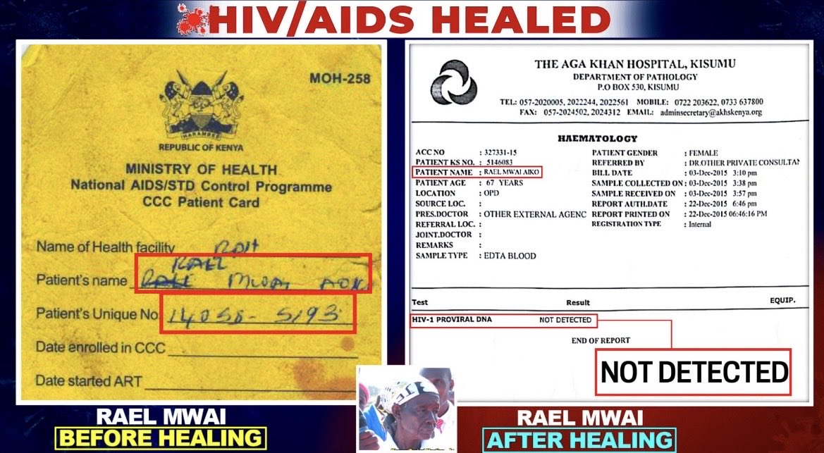 The Power of The Eternal Blood of JESUS! The undisputed Power.

Jesus heals HIV/AIDS.
#JesusTriumphantKing