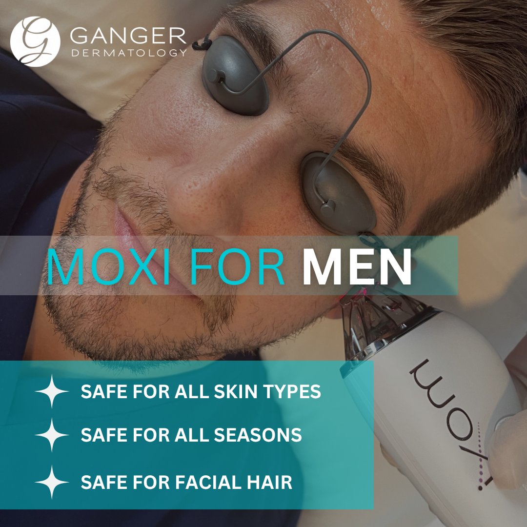 GangerDerm's tweet photo. MOXI for Men

MOXI is a gentle, non-ablative laser treatment designed to refresh and revitalize the skin with minimal downtime. It is ideal for addressing early sun damage, pigmentation, uneven skin tone, and signs of aging while helping maintain healthy, refreshed skin year-round.

Safe for all skin types, all seasons, and even areas with facial hair, MOXI is a versatile treatment that can be performed on the face, neck, chest, hands, arms, and legs. Whether you are starting a skincare routine or maintaining long-term skin health, MOXI offers a comfortable and effective solution for smoother, brighter, more even-looking skin.

Ready for healthier, refreshed skin? Schedule your MOXI consultation today!