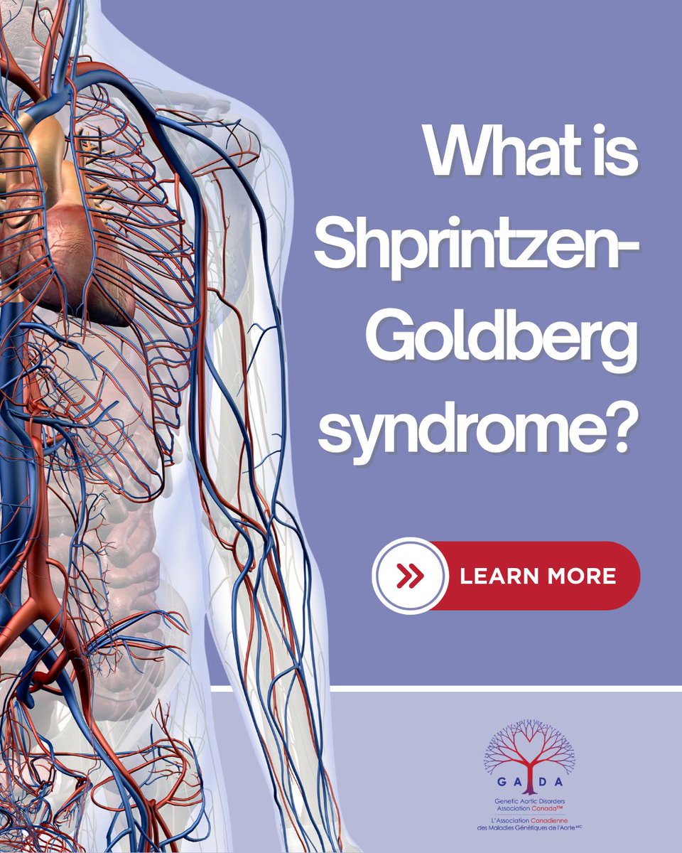 AorticDisorders's tweet photo. New research is expanding what we know about Shprintzen‑Goldberg syndrome (SGS).
Learn more by reading the full study: https://t.co/xDcIyLL2JO
#ShprintzenGoldberg #RareDisease #Genetics #Cardiovascular #Health #Research #NewStudy #Marfan https://t.co/YFwyayVsuY
