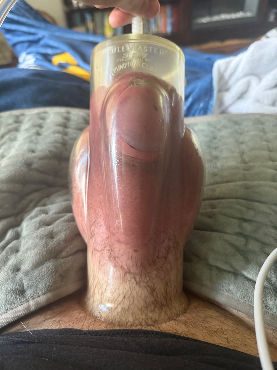 mellowbean87's tweet photo. New personal best! Man I love being this huge. #ballpumping #pumping #hugeballs #pumpedballs #bullmaster #hugenuts #pumpedballs #pumpednuts #bigballs #bignuts https://t.co/jiaY3xIdO1