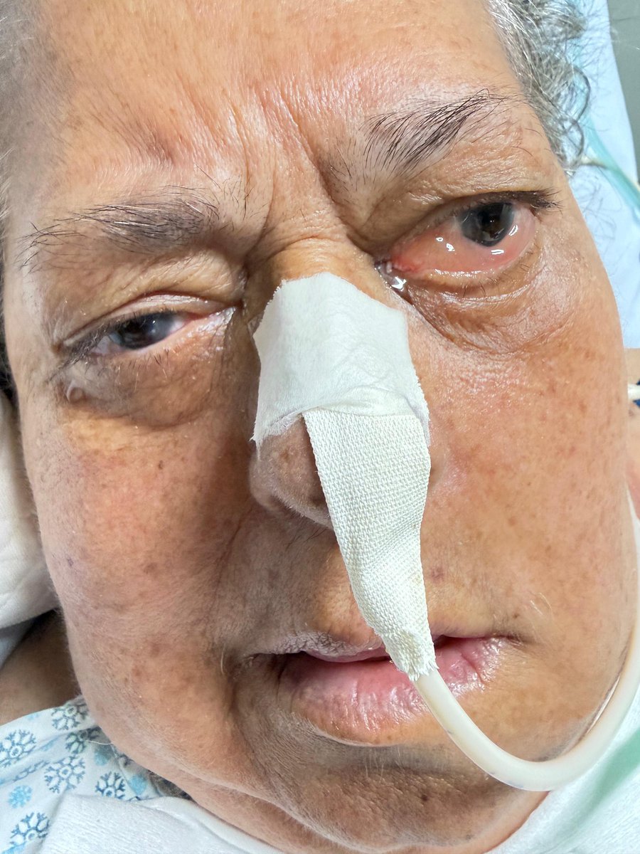 laisarabelo's tweet photo. Quando normalizaram médicos escolher qual paciente pode vir a óbito por falta de uma dialise, e chamaram isso de cuidado de fim de vida, onde nem fralda mais trocavam por 60 dias? LEI não permite eutanásia, esta errado CFM tutelar essa covardia sob argumento que vai morrer mesmo. https://t.co/pyyY5O75as