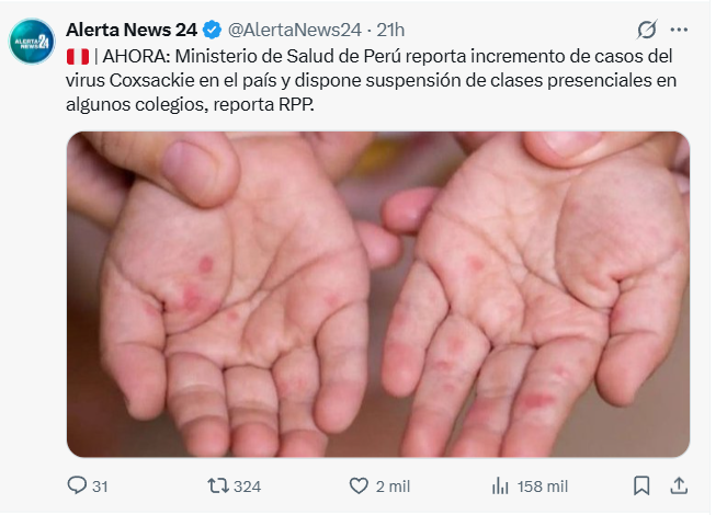 Francisco V tweet media
