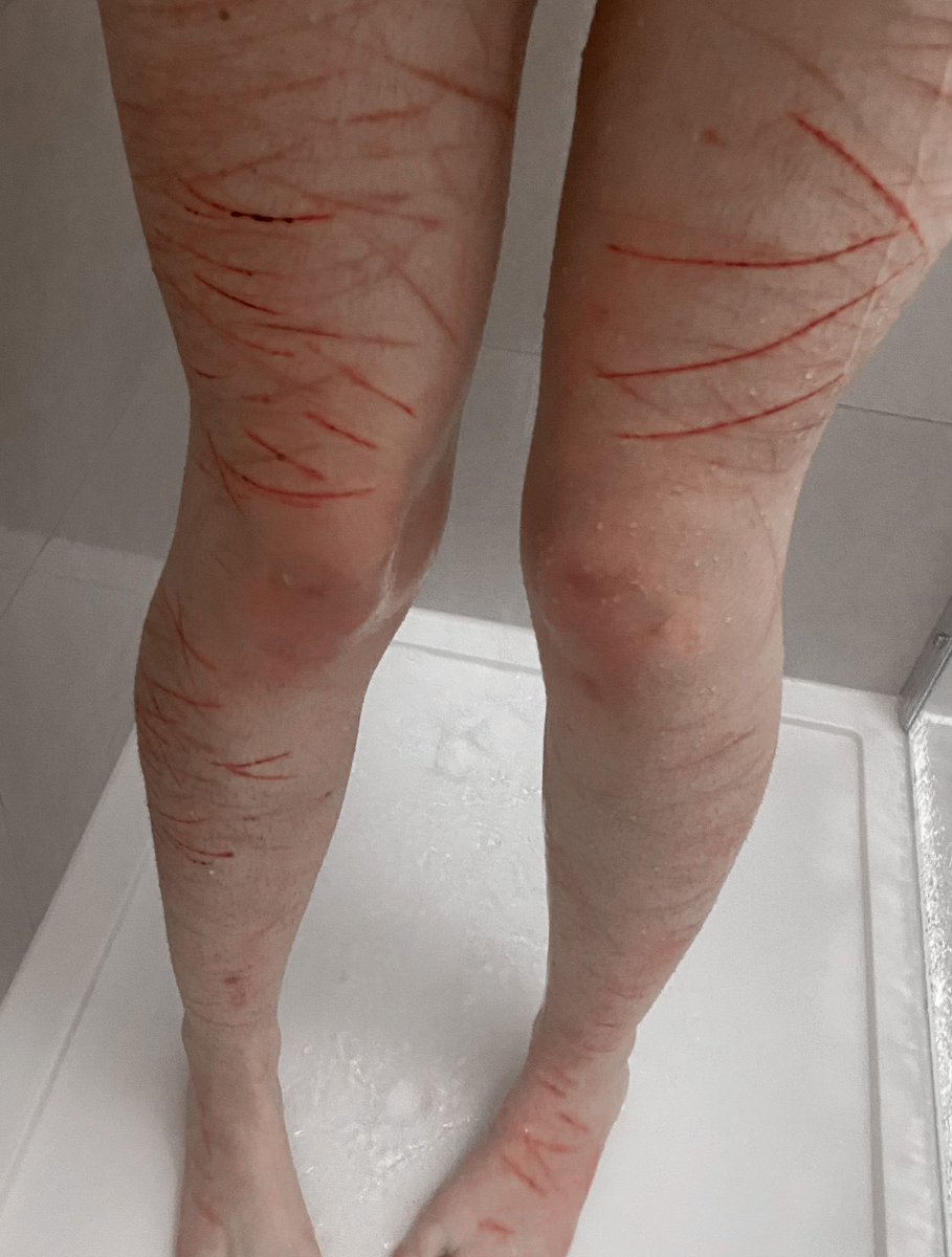 blade352337's tweet photo. u ever cut all the way down to ur feet? lmao
#sh #slitwt #shtwt #slittwt https://t.co/RkcCOuU4am