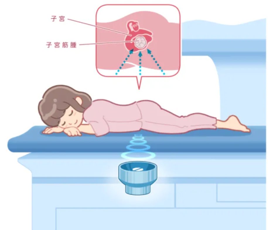 bigsmallers's tweet photo. 婦人科HIFU研究会の公式サイトでは、子宮筋腫や子宮腺筋症に対する切らない日帰り治療「HIFU（ハイフ）」を紹介しています。
https://t.co/ve1qYcThts

＃子宮筋腫　＃子宮腺筋症
＃ハイフ https://t.co/EvpMbyfw4V