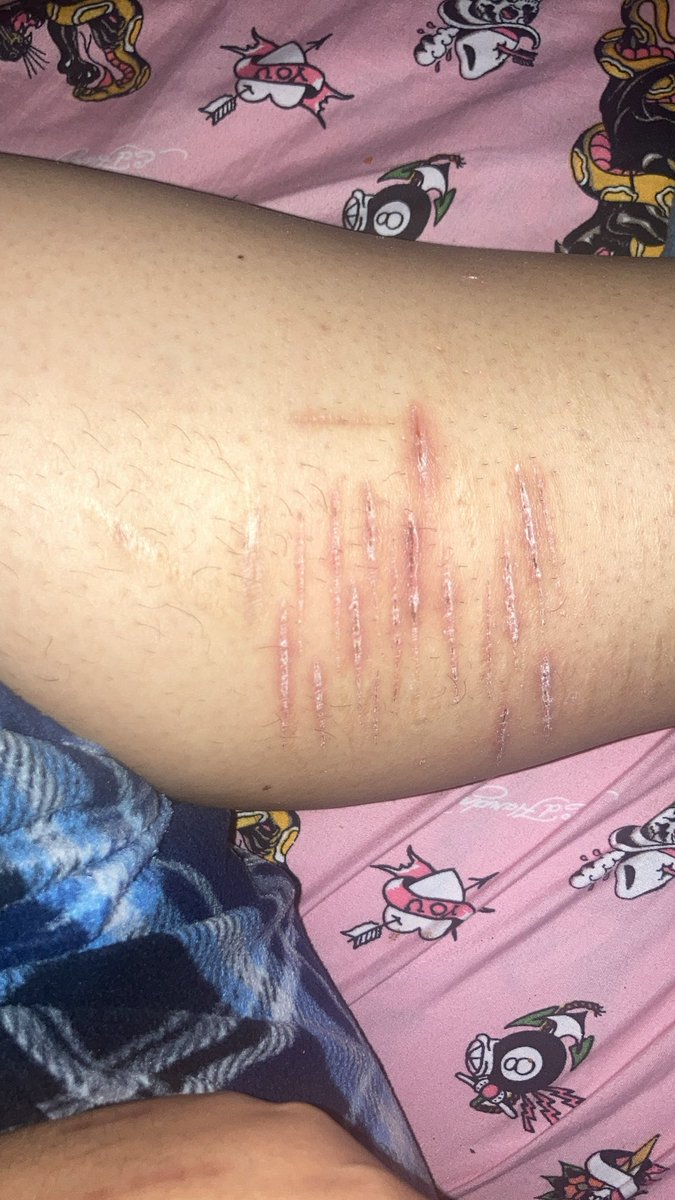 bonesunderblood's tweet photo. Pathetic https://t.co/XP1D5T5gHv