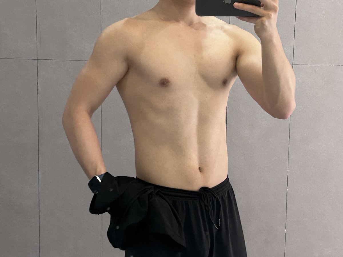 Timo72299971948's tweet photo. 手术完，第一天，还可以，只有刚做完手术五个小时内比较痛，剩下的时间几乎没有疼痛，晚上五点过勃起了一会，消下去就好了 https://t.co/VEbogEAr6H